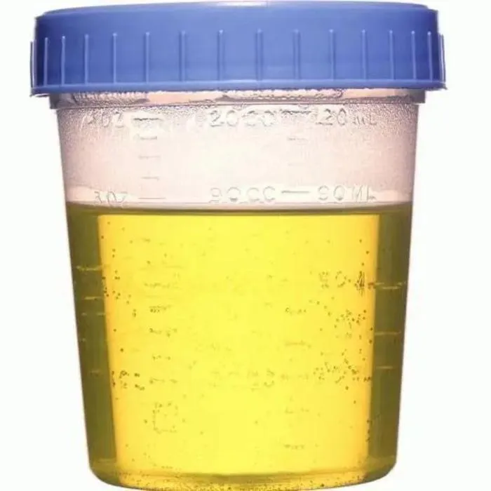 Urine Specimen Collection Cup, Sterile Individually wrapped